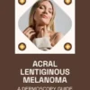 Acral Lentiginous Melanoma