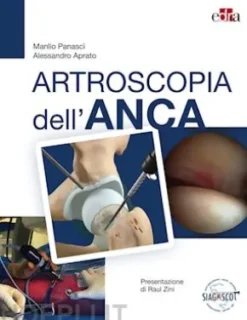 Artroscopia dell'anca