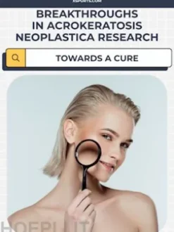 Breakthroughs in Acrokeratosis Neoplastica Research