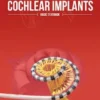 Cochlear Implants - Basic Textbook