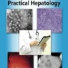 Comprehensive Practical Hepatology