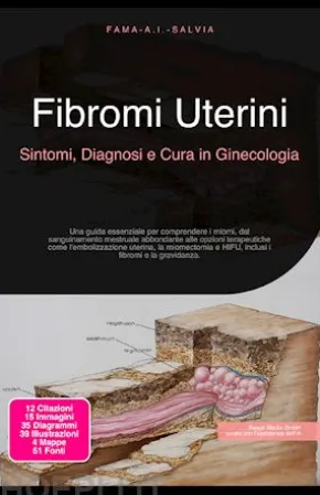 Fibromi Uterini: Sintomi, Diagnosi e Cura in Ginecologia