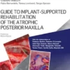 GUIDE TO IMPLANT-SUPPORTED REHABILITATION OF THE ATROPHIC POSTERIOR MAXILLA