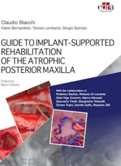 GUIDE TO IMPLANT-SUPPORTED REHABILITATION OF THE ATROPHIC POSTERIOR MAXILLA