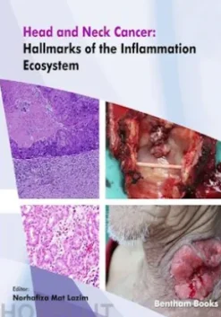 Head and Neck Cancer: Hallmarks of the Inflammation Ecosystem