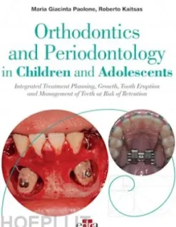 Orthodontics and Periodontology in Children and Adolescents