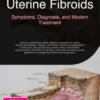 Uterine Fibroids: Symptoms, Diagnosis, and Modern Treatment